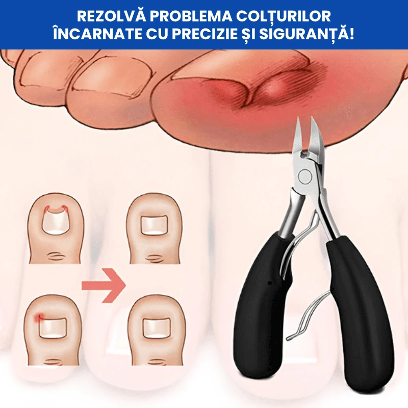 TRUSA UNGHII GROASE 3